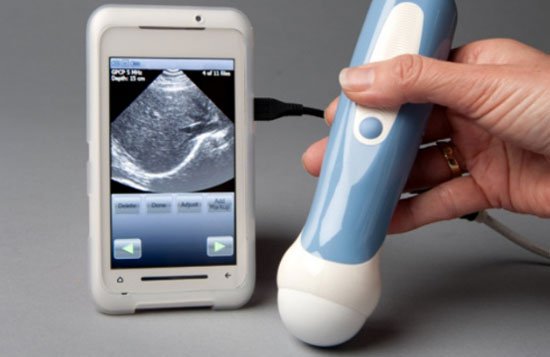 Siêu âm trên smartphone - đột phá mới cho y học